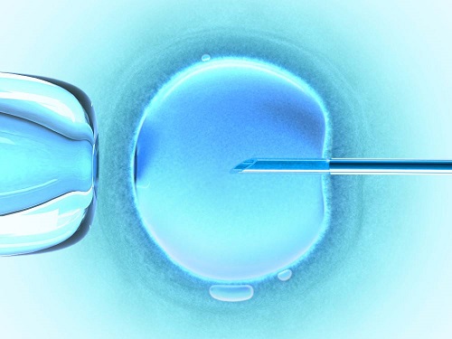 美国试管单精子注射受精率高的两大重要保障