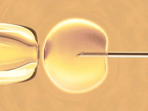 美国试管专家解读：囊胚培育和基因检测的重要意义